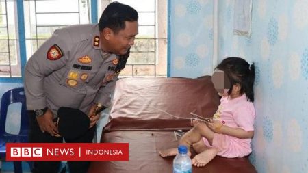 Kasus seorang bocah patah kaki permanen di Nias, bibi korban adalah seorang tersangka