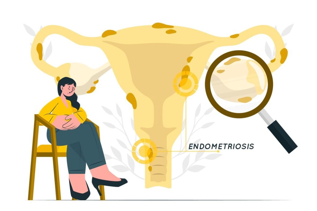 Tiga cara pemeriksaan tuba fallopi, kerusakan terbanyak disebabkan oleh infeksi dan endometriosis