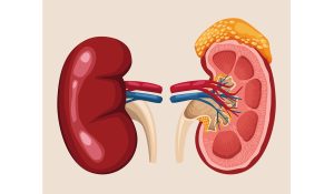 Pasien dengan hipertensi, diabetes, dan obesitas rentan terhadap gagal ginjal